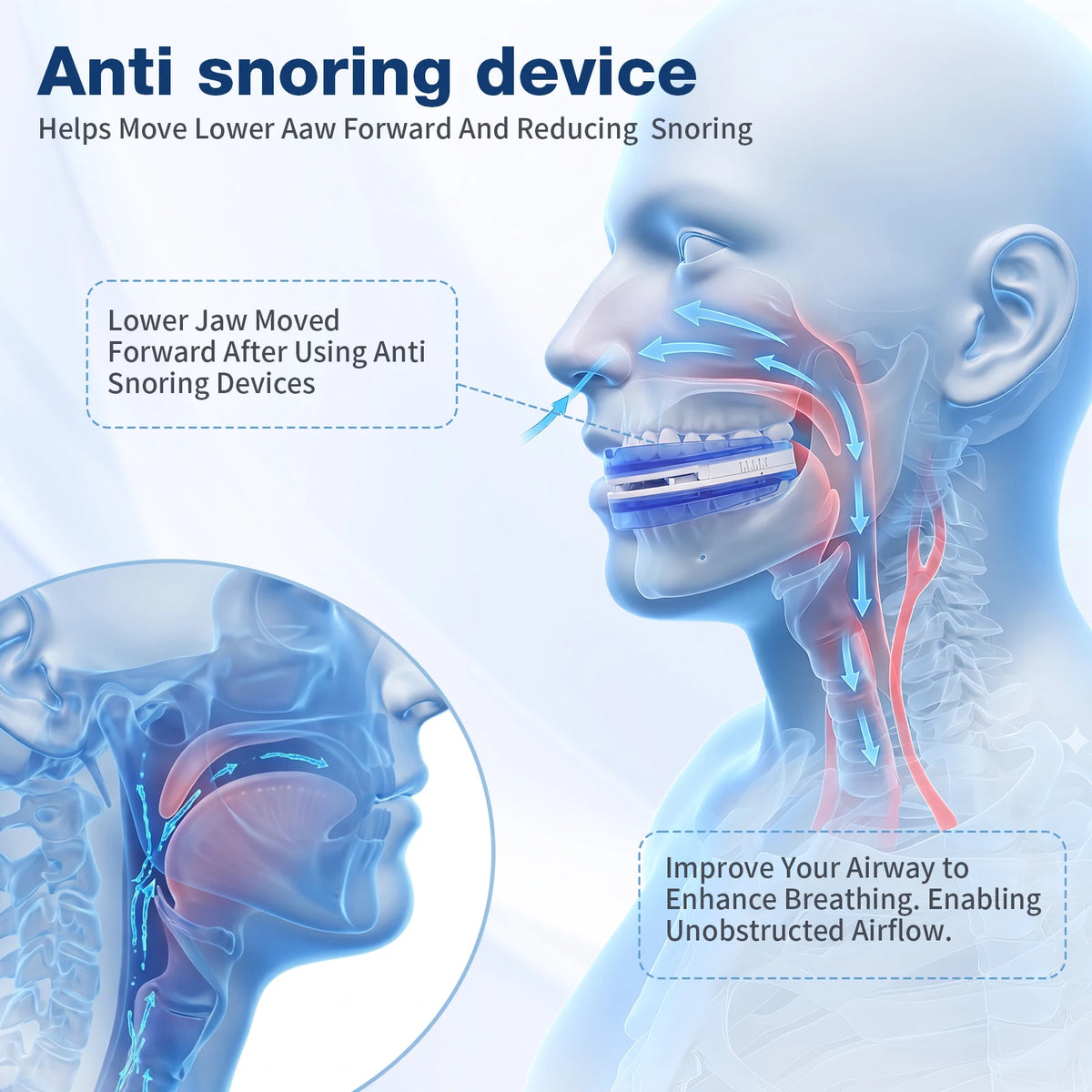 Adjustable Anti Snoring Mouthpiece Custom Fit Sleep Aid With Airflow